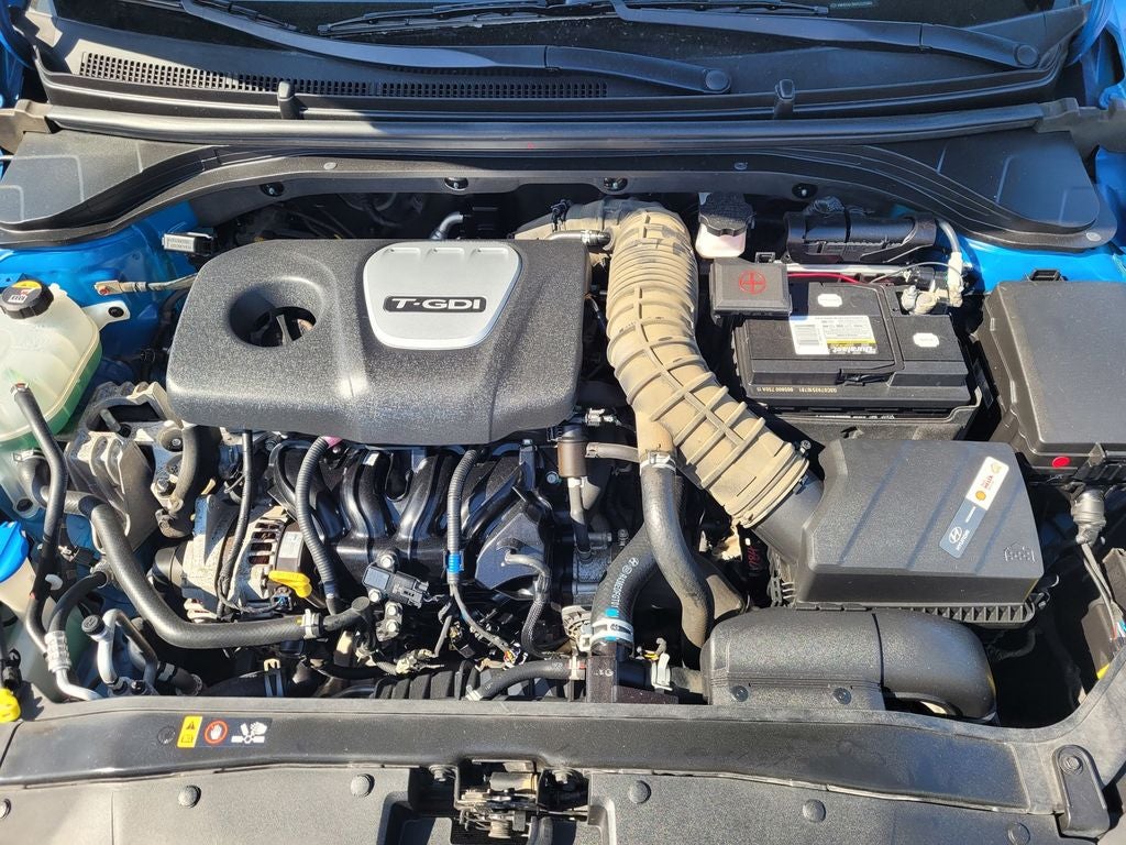 2017 Hyundai Elantra Sport