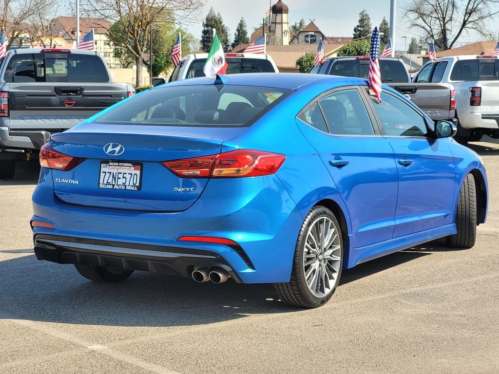 2017 Hyundai Elantra Sport